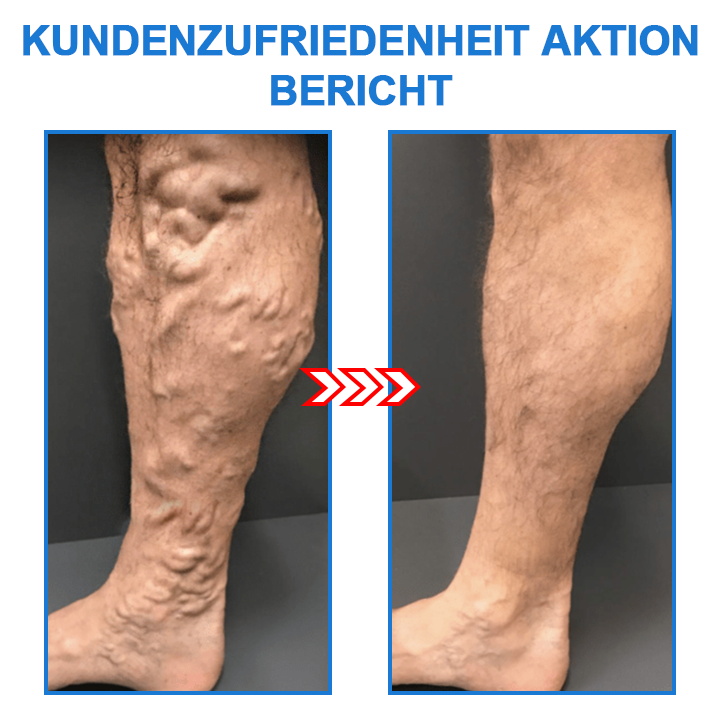 Ionische elastische sokken | 1+1 GRATIS